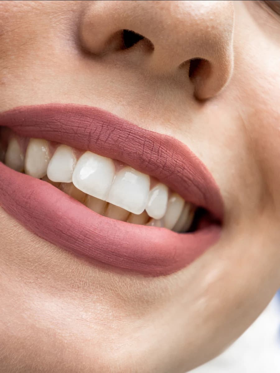 A confident, natural smile after full-arch treatment